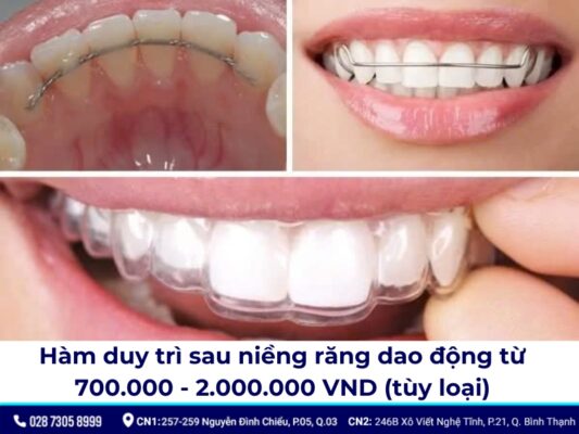 hàm duy trì sau niềng răng - ảnh 5 hàm duy trì sau niềng răng - ảnh 5