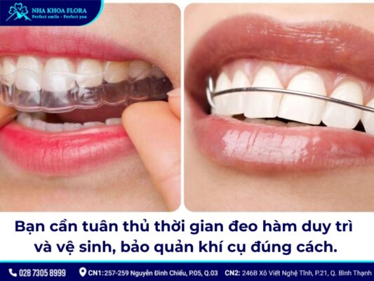 hàm duy trì sau niềng răng - ảnh 6 hàm duy trì sau niềng răng - ảnh 6