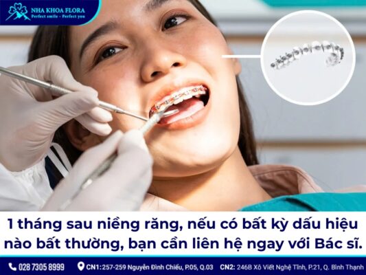 kết quả niềng răng sau 1 tháng - ảnh 2 kết quả niềng răng sau 1 tháng - ảnh 2