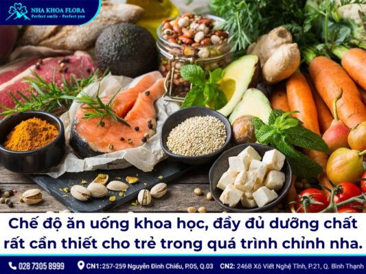lưu ý khi niềng răng cho trẻ - ảnh 5 lưu ý khi niềng răng cho trẻ - ảnh 5