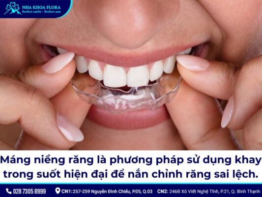 máng niềng răng - ảnh 1 máng niềng răng - ảnh 1