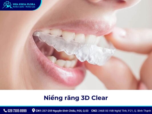 máng niềng răng - ảnh 3 máng niềng răng - ảnh 3
