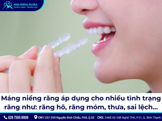 máng niềng răng - ảnh 6 máng niềng răng - ảnh 6