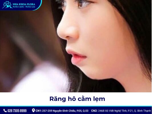 niềng răng hô tại nhà - ảnh 6 niềng răng hô tại nhà - ảnh 6