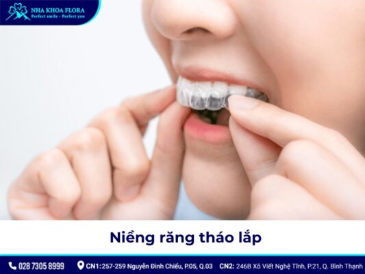 niềng răng hô tại nhà - ảnh 7 niềng răng hô tại nhà - ảnh 7