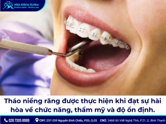 tháo niềng răng - ảnh 2 tháo niềng răng - ảnh 2