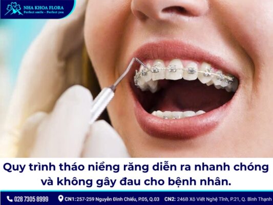 tháo niềng răng - ảnh 3 tháo niềng răng - ảnh 3
