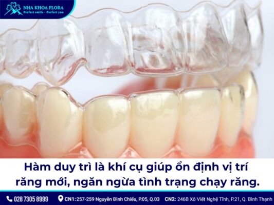 niềng răng đeo hàm duy trì bao lâu - ảnh 1 niềng răng đeo hàm duy trì bao lâu - ảnh 1