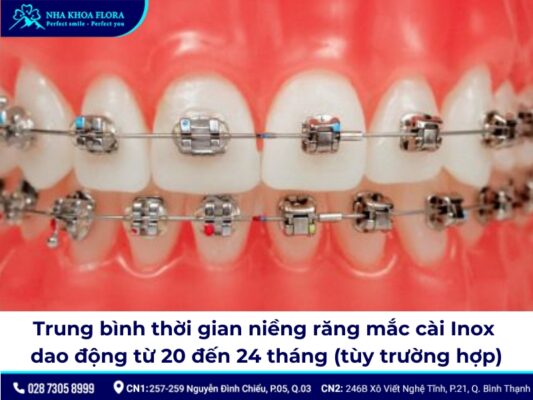 niềng răng inox đơn giản - ảnh 3 niềng răng inox đơn giản - ảnh 3