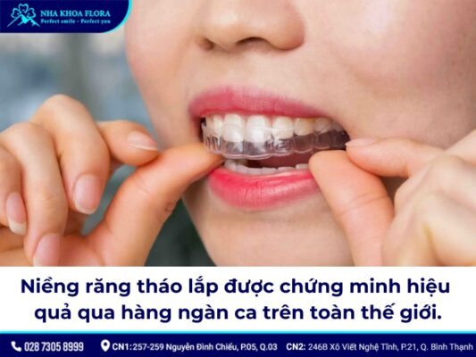 niềng răng tháo lắp - ảnh 9 niềng răng tháo lắp - ảnh 9